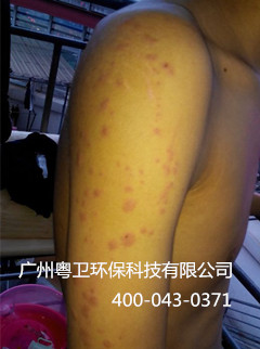 廣州滅臭蟲(chóng)公司